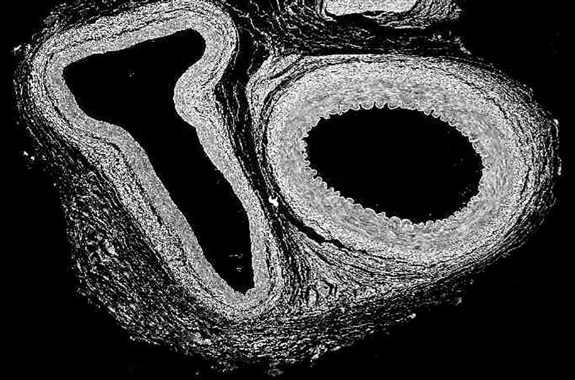 Embedded figure page 14